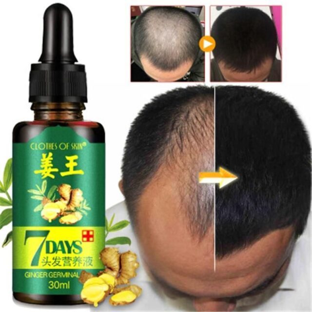 7Days Haarwuchsserum – Bild 3
