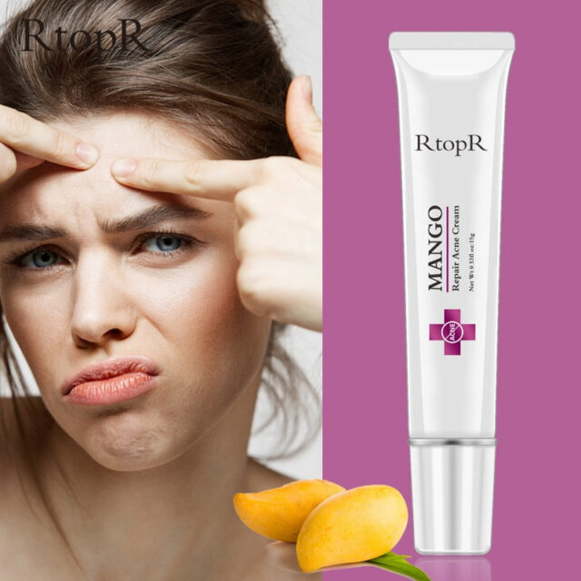 Mango Anti-Akne Creme – Entfernt Pickel & Verkleinert Poren 15g – Bild 5